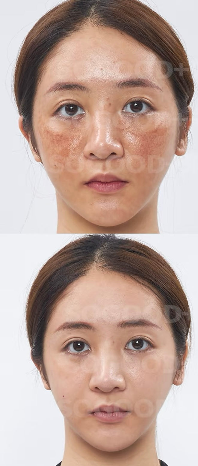 Skin Lightner Cream